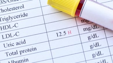 uric acid levels in the body
